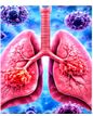 Respiratory Infections